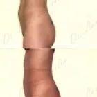 71 üzleti kép ZSÍRLESZÍVÁS KLINIKA DR LÁNYI CECÍLIA Plasztikai sebészet ban/ben Budapest