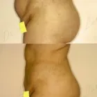 73 üzleti kép ZSÍRLESZÍVÁS KLINIKA DR LÁNYI CECÍLIA Plasztikai sebészet ban/ben Budapest