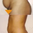 74 üzleti kép ZSÍRLESZÍVÁS KLINIKA DR LÁNYI CECÍLIA Plasztikai sebészet ban/ben Budapest