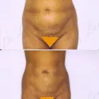 75 üzleti kép ZSÍRLESZÍVÁS KLINIKA DR LÁNYI CECÍLIA Plasztikai sebészet ban/ben Budapest