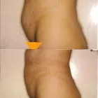 76 üzleti kép ZSÍRLESZÍVÁS KLINIKA DR LÁNYI CECÍLIA Plasztikai sebészet ban/ben Budapest