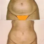 77 üzleti kép ZSÍRLESZÍVÁS KLINIKA DR LÁNYI CECÍLIA Plasztikai sebészet ban/ben Budapest