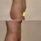 86 üzleti kép ZSÍRLESZÍVÁS KLINIKA DR LÁNYI CECÍLIA Plasztikai sebészet ban/ben Budapest