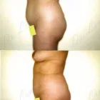 88 üzleti kép ZSÍRLESZÍVÁS KLINIKA DR LÁNYI CECÍLIA Plasztikai sebészet ban/ben Budapest