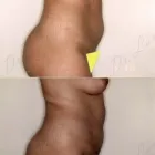 90 üzleti kép ZSÍRLESZÍVÁS KLINIKA DR LÁNYI CECÍLIA Plasztikai sebészet ban/ben Budapest