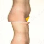 92 üzleti kép ZSÍRLESZÍVÁS KLINIKA DR LÁNYI CECÍLIA Plasztikai sebészet ban/ben Budapest