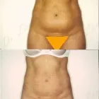 95 üzleti kép ZSÍRLESZÍVÁS KLINIKA DR LÁNYI CECÍLIA Plasztikai sebészet ban/ben Budapest