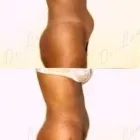 97 üzleti kép ZSÍRLESZÍVÁS KLINIKA DR LÁNYI CECÍLIA Plasztikai sebészet ban/ben Budapest