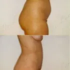 99 üzleti kép ZSÍRLESZÍVÁS KLINIKA DR LÁNYI CECÍLIA Plasztikai sebészet ban/ben Budapest