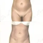 107 üzleti kép ZSÍRLESZÍVÁS KLINIKA DR LÁNYI CECÍLIA Plasztikai sebészet ban/ben Budapest