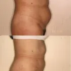 111 üzleti kép ZSÍRLESZÍVÁS KLINIKA DR LÁNYI CECÍLIA Plasztikai sebészet ban/ben Budapest