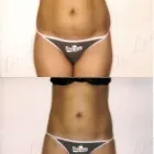 113 üzleti kép ZSÍRLESZÍVÁS KLINIKA DR LÁNYI CECÍLIA Plasztikai sebészet ban/ben Budapest