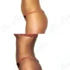 114 üzleti kép ZSÍRLESZÍVÁS KLINIKA DR LÁNYI CECÍLIA Plasztikai sebészet ban/ben Budapest