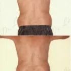 117 üzleti kép ZSÍRLESZÍVÁS KLINIKA DR LÁNYI CECÍLIA Plasztikai sebészet ban/ben Budapest