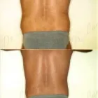 119 üzleti kép ZSÍRLESZÍVÁS KLINIKA DR LÁNYI CECÍLIA Plasztikai sebészet ban/ben Budapest