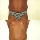 121 üzleti kép ZSÍRLESZÍVÁS KLINIKA DR LÁNYI CECÍLIA Plasztikai sebészet ban/ben Budapest