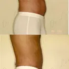 122 üzleti kép ZSÍRLESZÍVÁS KLINIKA DR LÁNYI CECÍLIA Plasztikai sebészet ban/ben Budapest