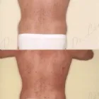 123 üzleti kép ZSÍRLESZÍVÁS KLINIKA DR LÁNYI CECÍLIA Plasztikai sebészet ban/ben Budapest