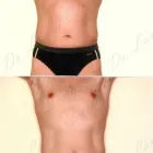 124 üzleti kép ZSÍRLESZÍVÁS KLINIKA DR LÁNYI CECÍLIA Plasztikai sebészet ban/ben Budapest