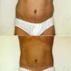 128 üzleti kép ZSÍRLESZÍVÁS KLINIKA DR LÁNYI CECÍLIA Plasztikai sebészet ban/ben Budapest