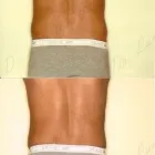 129 üzleti kép ZSÍRLESZÍVÁS KLINIKA DR LÁNYI CECÍLIA Plasztikai sebészet ban/ben Budapest