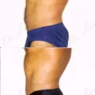 131 üzleti kép ZSÍRLESZÍVÁS KLINIKA DR LÁNYI CECÍLIA Plasztikai sebészet ban/ben Budapest