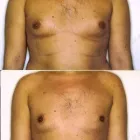 132 üzleti kép ZSÍRLESZÍVÁS KLINIKA DR LÁNYI CECÍLIA Plasztikai sebészet ban/ben Budapest