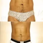 134 üzleti kép ZSÍRLESZÍVÁS KLINIKA DR LÁNYI CECÍLIA Plasztikai sebészet ban/ben Budapest