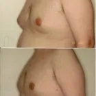 135 üzleti kép ZSÍRLESZÍVÁS KLINIKA DR LÁNYI CECÍLIA Plasztikai sebészet ban/ben Budapest