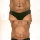 136 üzleti kép ZSÍRLESZÍVÁS KLINIKA DR LÁNYI CECÍLIA Plasztikai sebészet ban/ben Budapest