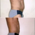 137 üzleti kép ZSÍRLESZÍVÁS KLINIKA DR LÁNYI CECÍLIA Plasztikai sebészet ban/ben Budapest