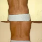 138 üzleti kép ZSÍRLESZÍVÁS KLINIKA DR LÁNYI CECÍLIA Plasztikai sebészet ban/ben Budapest