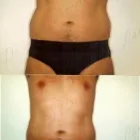 139 üzleti kép ZSÍRLESZÍVÁS KLINIKA DR LÁNYI CECÍLIA Plasztikai sebészet ban/ben Budapest