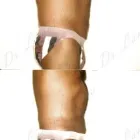 141 üzleti kép ZSÍRLESZÍVÁS KLINIKA DR LÁNYI CECÍLIA Plasztikai sebészet ban/ben Budapest