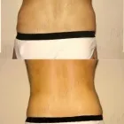 142 üzleti kép ZSÍRLESZÍVÁS KLINIKA DR LÁNYI CECÍLIA Plasztikai sebészet ban/ben Budapest