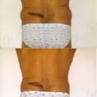 143 üzleti kép ZSÍRLESZÍVÁS KLINIKA DR LÁNYI CECÍLIA Plasztikai sebészet ban/ben Budapest