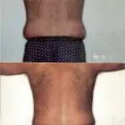 144 üzleti kép ZSÍRLESZÍVÁS KLINIKA DR LÁNYI CECÍLIA Plasztikai sebészet ban/ben Budapest