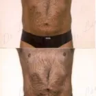 146 üzleti kép ZSÍRLESZÍVÁS KLINIKA DR LÁNYI CECÍLIA Plasztikai sebészet ban/ben Budapest