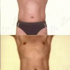 147 üzleti kép ZSÍRLESZÍVÁS KLINIKA DR LÁNYI CECÍLIA Plasztikai sebészet ban/ben Budapest