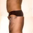 148 üzleti kép ZSÍRLESZÍVÁS KLINIKA DR LÁNYI CECÍLIA Plasztikai sebészet ban/ben Budapest