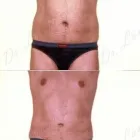 149 üzleti kép ZSÍRLESZÍVÁS KLINIKA DR LÁNYI CECÍLIA Plasztikai sebészet ban/ben Budapest