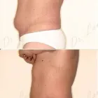 150 üzleti kép ZSÍRLESZÍVÁS KLINIKA DR LÁNYI CECÍLIA Plasztikai sebészet ban/ben Budapest