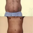 151 üzleti kép ZSÍRLESZÍVÁS KLINIKA DR LÁNYI CECÍLIA Plasztikai sebészet ban/ben Budapest