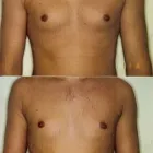 152 üzleti kép ZSÍRLESZÍVÁS KLINIKA DR LÁNYI CECÍLIA Plasztikai sebészet ban/ben Budapest