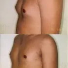 153 üzleti kép ZSÍRLESZÍVÁS KLINIKA DR LÁNYI CECÍLIA Plasztikai sebészet ban/ben Budapest