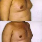 155 üzleti kép ZSÍRLESZÍVÁS KLINIKA DR LÁNYI CECÍLIA Plasztikai sebészet ban/ben Budapest