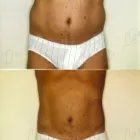 158 üzleti kép ZSÍRLESZÍVÁS KLINIKA DR LÁNYI CECÍLIA Plasztikai sebészet ban/ben Budapest