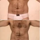 159 üzleti kép ZSÍRLESZÍVÁS KLINIKA DR LÁNYI CECÍLIA Plasztikai sebészet ban/ben Budapest