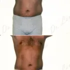 160 üzleti kép ZSÍRLESZÍVÁS KLINIKA DR LÁNYI CECÍLIA Plasztikai sebészet ban/ben Budapest