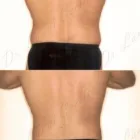 162 üzleti kép ZSÍRLESZÍVÁS KLINIKA DR LÁNYI CECÍLIA Plasztikai sebészet ban/ben Budapest